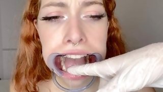 Dentists Mouth Exploration - teaser